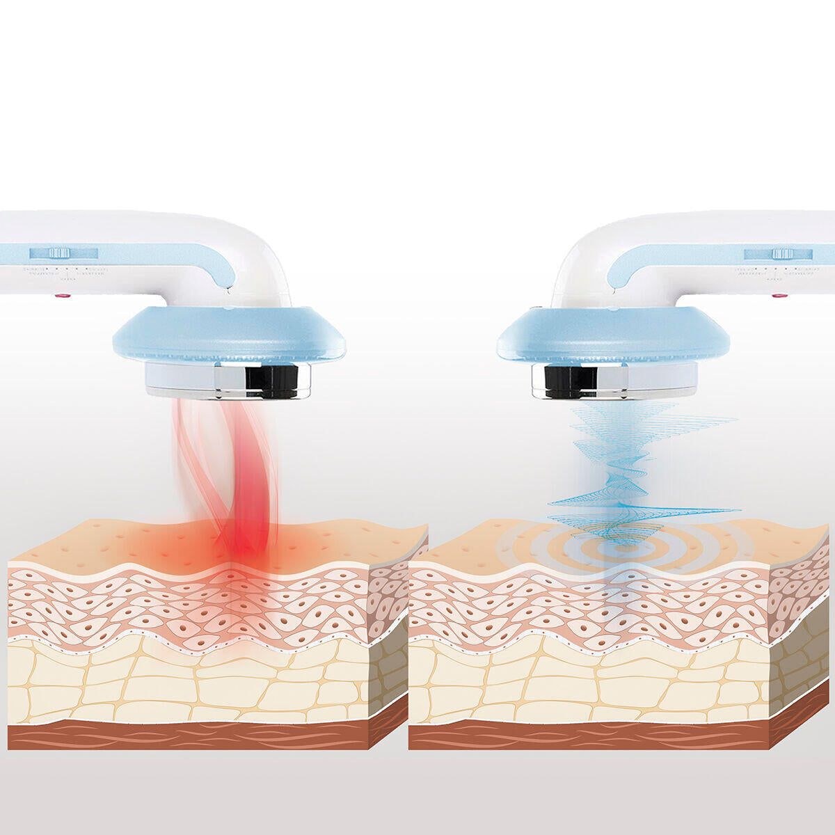 Masajeador Anticelulítico de Cavitación Ultrasónica con Infrarrojos y Electroestimulación 3 en 1 CellyMax - InnovaGoods
